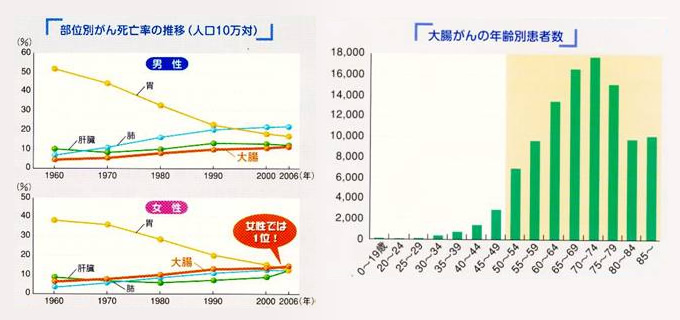 部位別がん死亡率の推移（人口10万対） 大腸がんの年齢別患者数